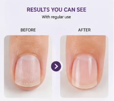 Nail Growth And Repair Serum (Pack of 1)